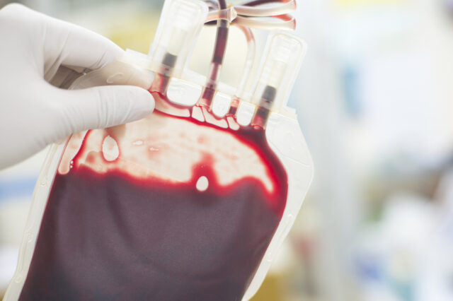 Close up of a blood bag in in a medical setting, being held by a person wearing medical gloves.