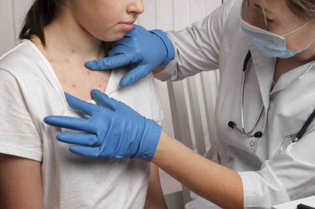 Doctor checking patient's chest for acne