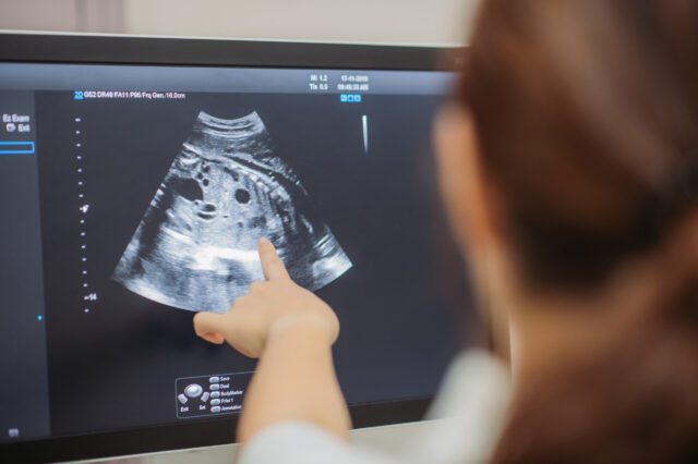 A doctor points to an expectant mother's sonogram. (Getty Images)