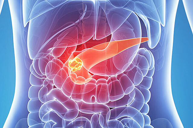 3D illustration of a pancreas