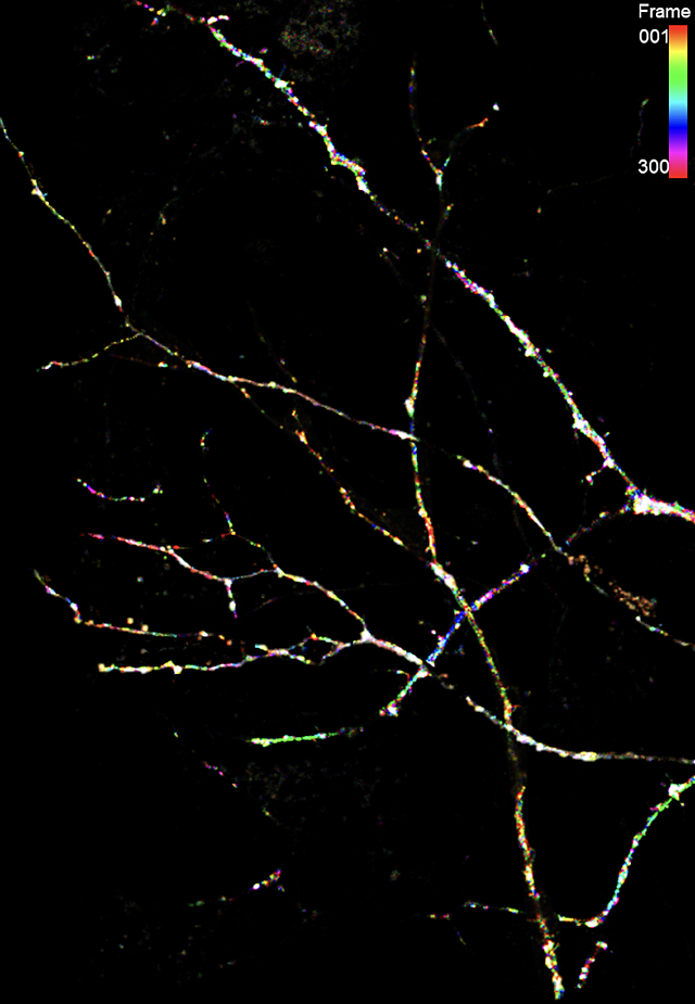 Green, blue and pink tags show the path of the SLAMR noncoding RNA as it moves within a neuron. Bumps on the branches are dendritic spines, critical for memory. Image by Jenna Wingfield, Ph.D., at The Wertheim UF Scripps Institute.