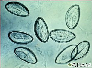 Pinworms fejlődési stádium. Alyaa Gad - Pinworm akik kezelik a helminthiasist
