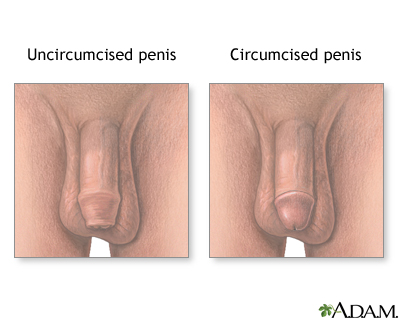 How To Clean A Uncircumcised Penis 88