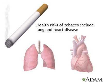 Tobacco health risks