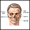 Craniofacial reconstruction - series