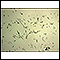 Campylobacter jejuni organism