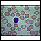 Red blood cells - normal