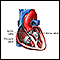 Heart valve surgery - Series