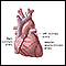 Передние артерии сердца
