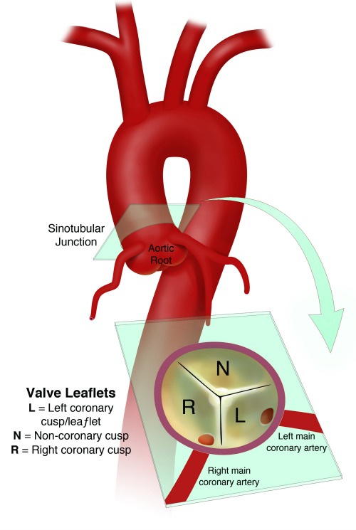 Aortic Valve and Root