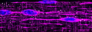 This image of a muscle cell highlights the intricate microtubule “highway system” (in magenta) that RNA cargo (white spots) uses to leave the nuclei (blue ovals) and move throughout the cell. The researchers' discoveries hinged on capturing images such as this, which were made possible by this study’s technological advances in molecular imaging. 