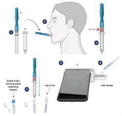 The CLIP-CAM technology for the Luminostics-UF team involves the collection of saliva by a collection pad on a "lollipop" stick that is set below and to the side of the tongue for 3-5 minutes until the indicator spot changes color, indicating the pad is full of saliva. The pad then is inserted into a syringe, and pushed down to release the saliva into a tube containing stabilizers. The CLIP cassette is affixed to the smartphone, and the corresponding "disease" cassette is inserted and the saliva is added to a port. The sample is then read by an app on the phone that uses the LED flash to initiate detection of SARS-CoV-2 virus antigen, anti-SARS-CoV-2 antibodies, or anemia and malaria parasite biomarkers. (Courtesy of (Courtesy of Dr. Bala Raja, Dr. Rhoel Dinglasan and BioRender.com)