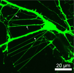 Nanotube tunnels (arrows) seen in medium spiny neurons using a confocal microscope. (Image courtesy of Subramaniam lab.)