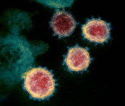 UF researchers use AI to foretell new coronavirus variants