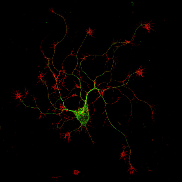A cultured mouse adult motor neuron imaged with a high-resolution multiphoton microscope (image courtesy of Dr. Erik Vitriol, UF Department of Cell Biology)