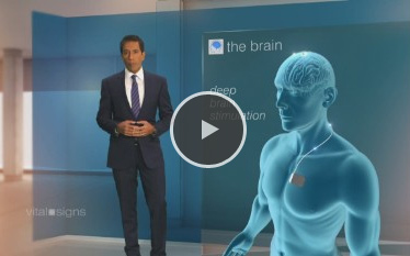 Vital Signs - Sanjay Gupta - CNN - What is Deep Brain Stimulation