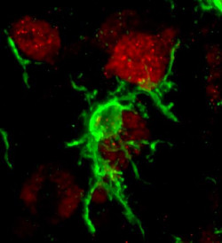 Image of brain microglia cells