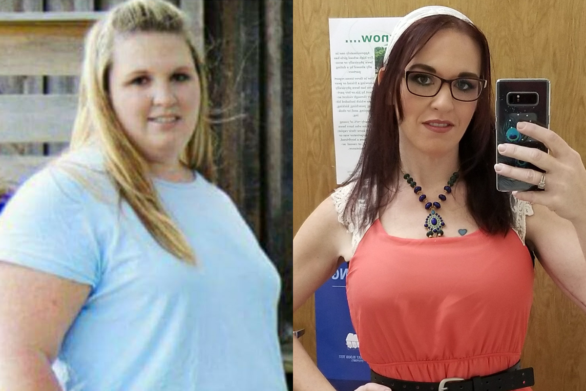 Christina Mandeville before and after visiting the UF Health Weight Loss Surgery Center