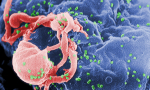 An electron microscope image of immature HIV budding from an immune cell. This image was provided by the Centers for Disease Control and Prevention.