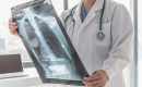 doctor holding up and looking at a chest x-ray